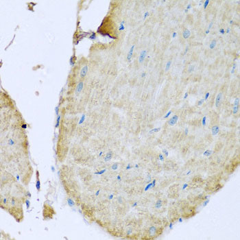 STING Antibody in Immunohistochemistry (Paraffin) (IHC (P))