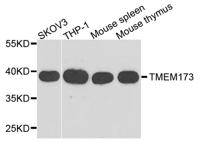 STING Antibody in Western Blot (WB)