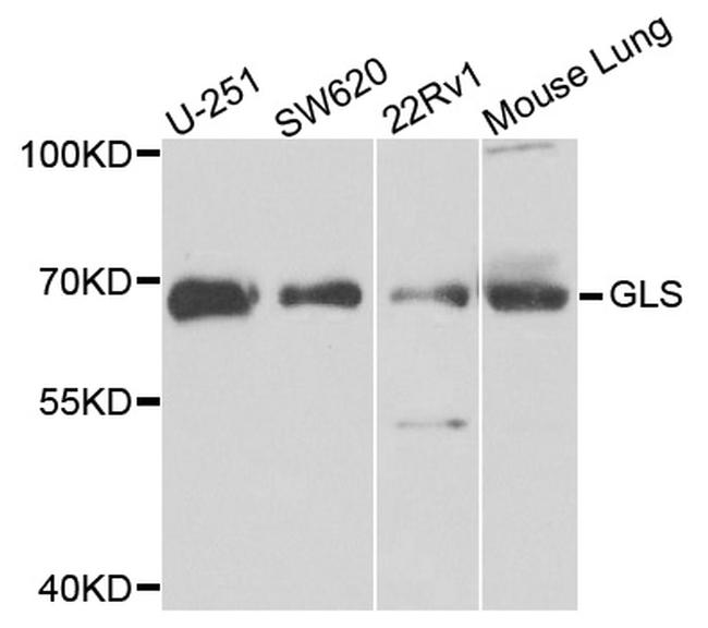 Glutaminase Antibody in Western Blot (WB)