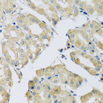 ABCF2 Antibody in Immunohistochemistry (Paraffin) (IHC (P))