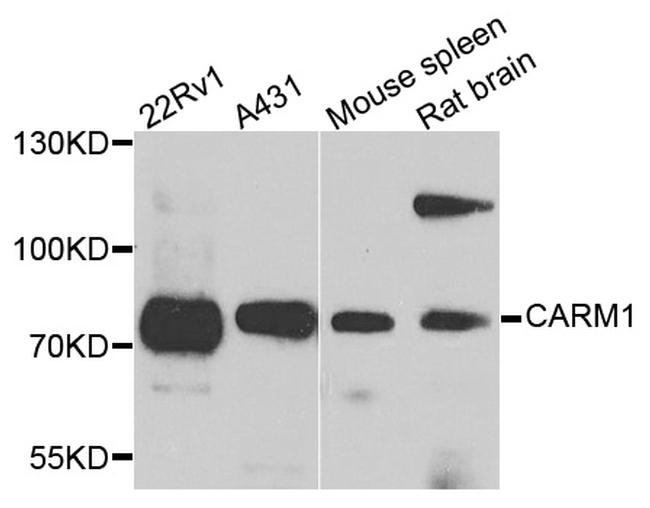 PRMT4 Antibody in Western Blot (WB)