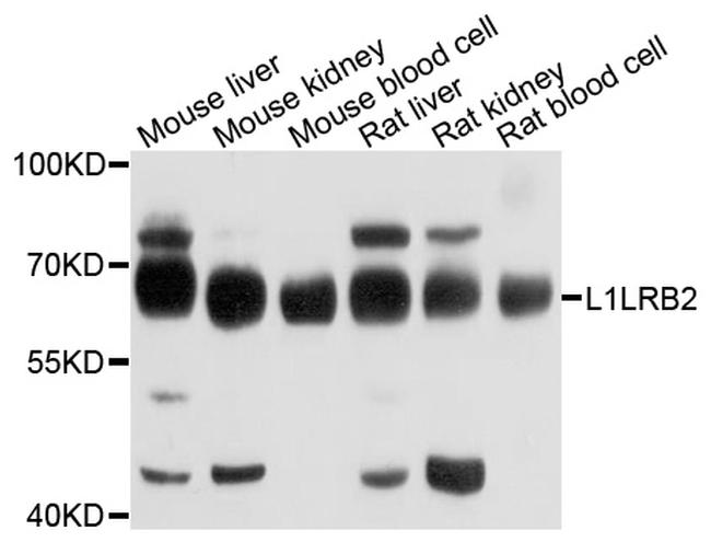 LILRB2 Antibody in Western Blot (WB)