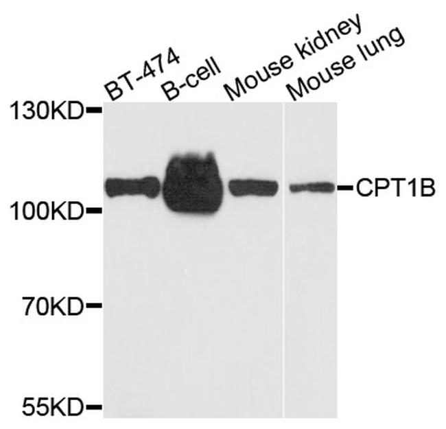 CPT1B Antibody in Western Blot (WB)