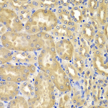 XIAP Antibody in Immunohistochemistry (Paraffin) (IHC (P))