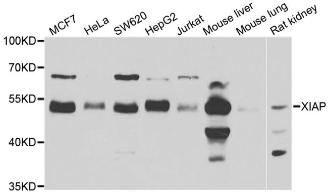 XIAP Antibody in Western Blot (WB)