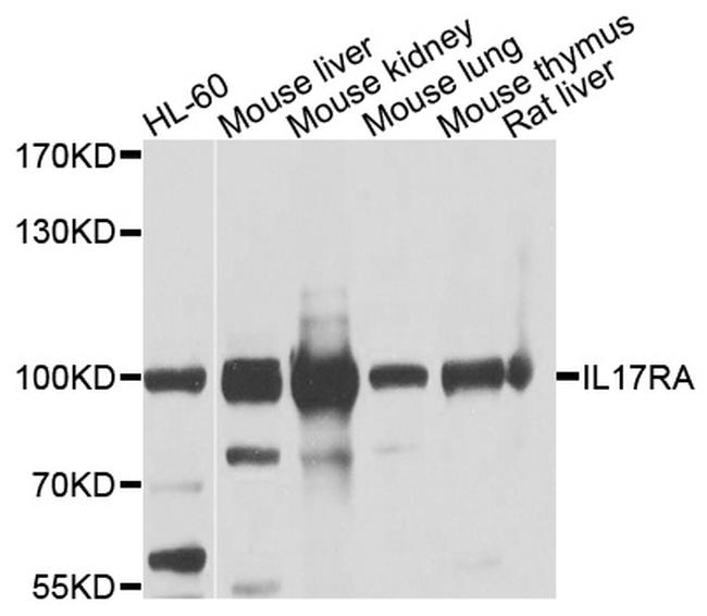 IL17RA Antibody in Western Blot (WB)