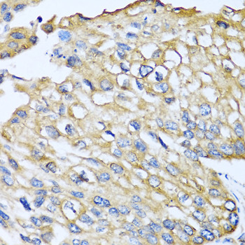 MCP-2 Antibody in Immunohistochemistry (Paraffin) (IHC (P))