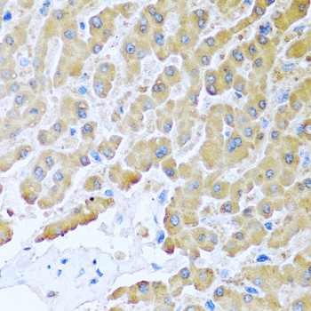 MCP-2 Antibody in Immunohistochemistry (Paraffin) (IHC (P))