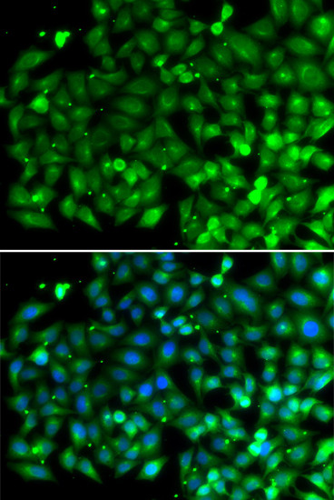 Bif1 Antibody in Immunocytochemistry (ICC/IF)