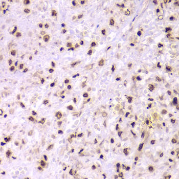 Ku70 Antibody in Immunohistochemistry (Paraffin) (IHC (P))