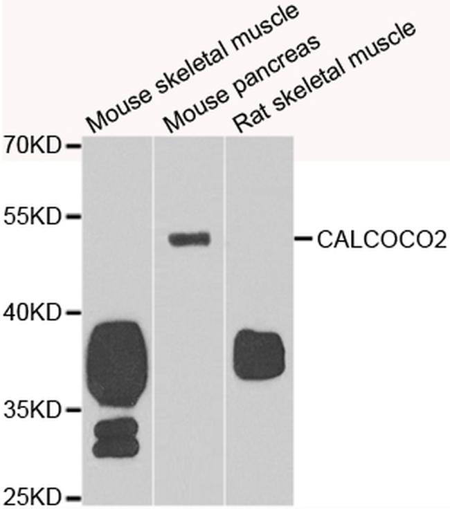 CALCOCO2 Antibody in Western Blot (WB)