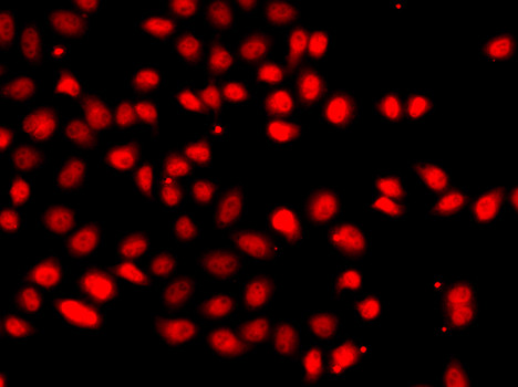 HIF-2 alpha Antibody in Immunocytochemistry (ICC/IF)