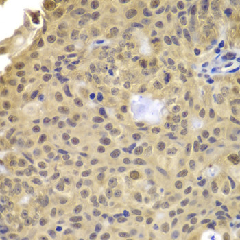 Cyclin A2 Antibody in Immunohistochemistry (Paraffin) (IHC (P))