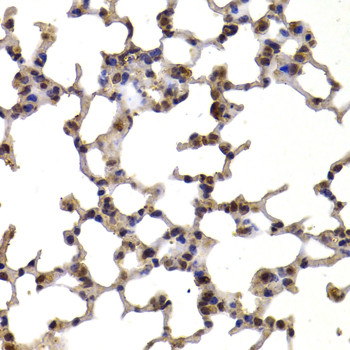 Thioredoxin 1 Antibody in Immunohistochemistry (Paraffin) (IHC (P))