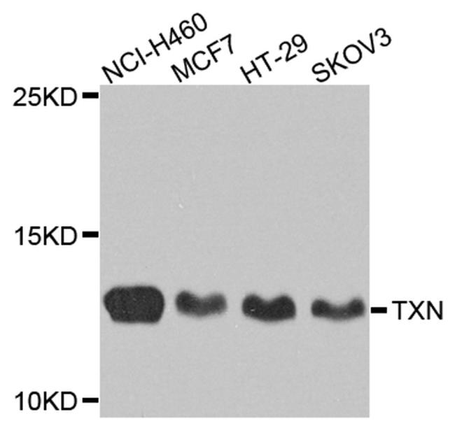 Thioredoxin 1 Antibody in Western Blot (WB)