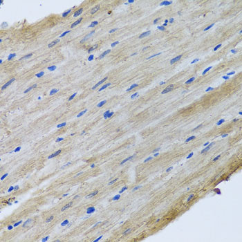 YBX1 Antibody in Immunohistochemistry (Paraffin) (IHC (P))