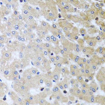 YBX1 Antibody in Immunohistochemistry (Paraffin) (IHC (P))