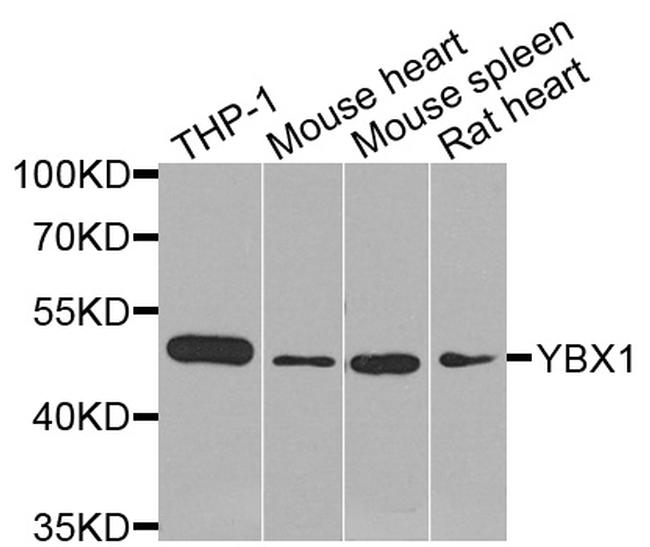 YBX1 Antibody in Western Blot (WB)