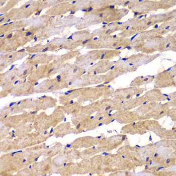 PSEN2 Antibody in Immunohistochemistry (Paraffin) (IHC (P))