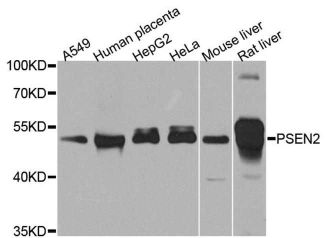 PSEN2 Antibody in Western Blot (WB)