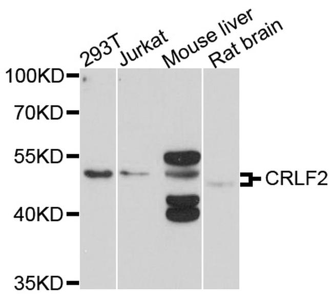 TSLP Receptor Antibody in Western Blot (WB)