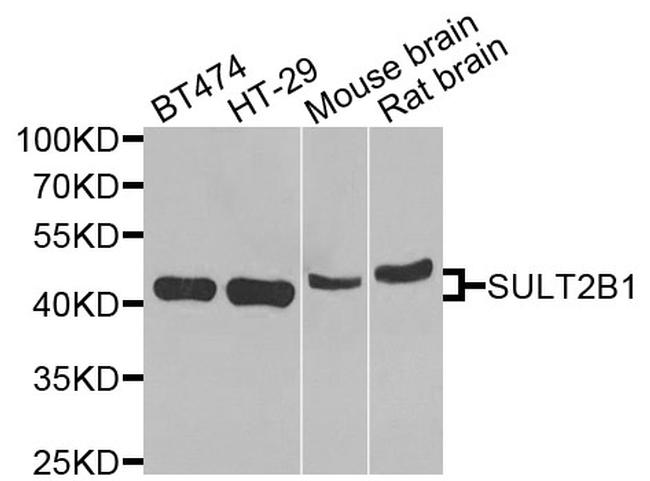 SULT2B1 Antibody in Western Blot (WB)