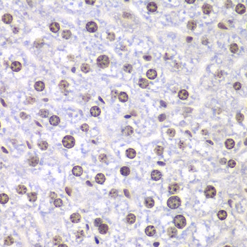 TOP1 Antibody in Immunohistochemistry (Paraffin) (IHC (P))