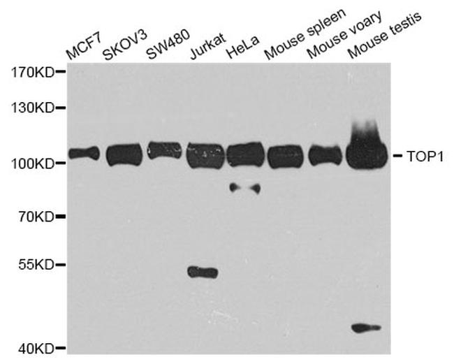 TOP1 Antibody in Western Blot (WB)