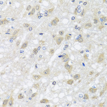 HARS2 Antibody in Immunohistochemistry (Paraffin) (IHC (P))