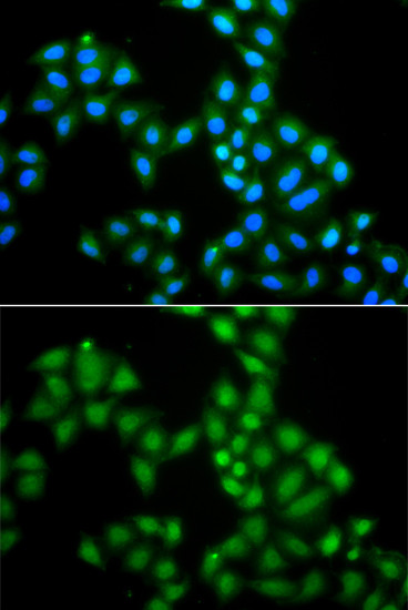 SAMHD1 Antibody in Immunocytochemistry (ICC/IF)