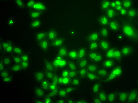 SAMHD1 Antibody in Immunocytochemistry (ICC/IF)