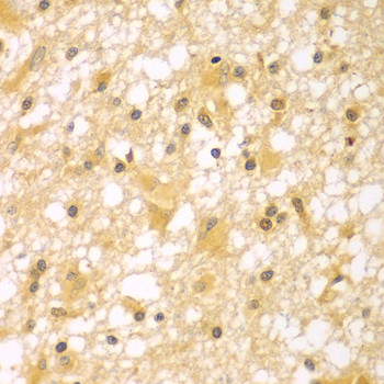 PAK6 Antibody in Immunohistochemistry (Paraffin) (IHC (P))