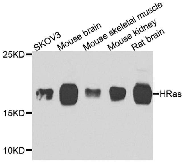 H-Ras Antibody in Western Blot (WB)