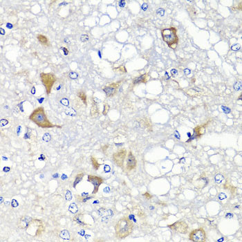 PSPH Antibody in Immunohistochemistry (Paraffin) (IHC (P))