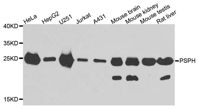 PSPH Antibody in Western Blot (WB)