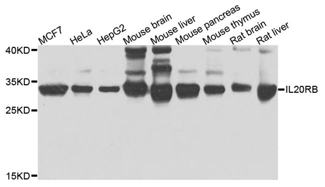 IL20RB Antibody in Western Blot (WB)