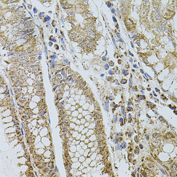 P-Selectin Antibody in Immunohistochemistry (Paraffin) (IHC (P))