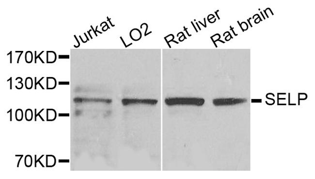 P-Selectin Antibody in Western Blot (WB)