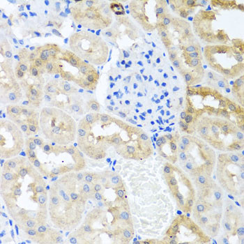 MYLK Antibody in Immunohistochemistry (Paraffin) (IHC (P))