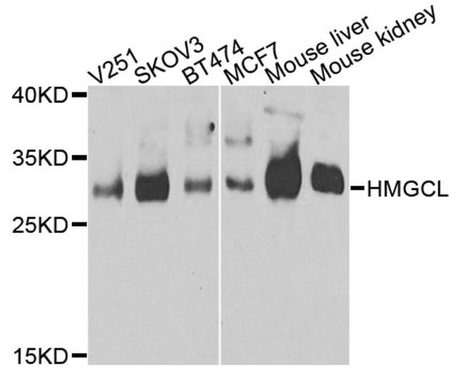 HMGCL Antibody in Western Blot (WB)