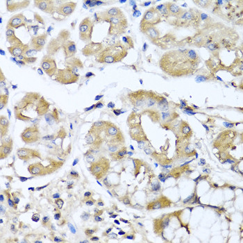 IL-29 Antibody in Immunohistochemistry (Paraffin) (IHC (P))