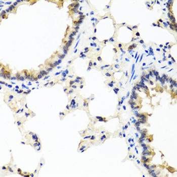 IL-29 Antibody in Immunohistochemistry (Paraffin) (IHC (P))