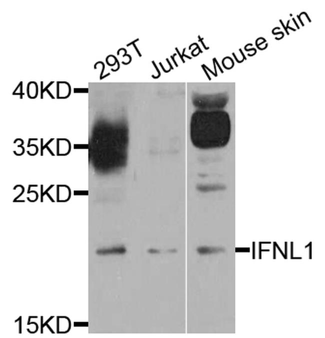 IL-29 Antibody in Western Blot (WB)