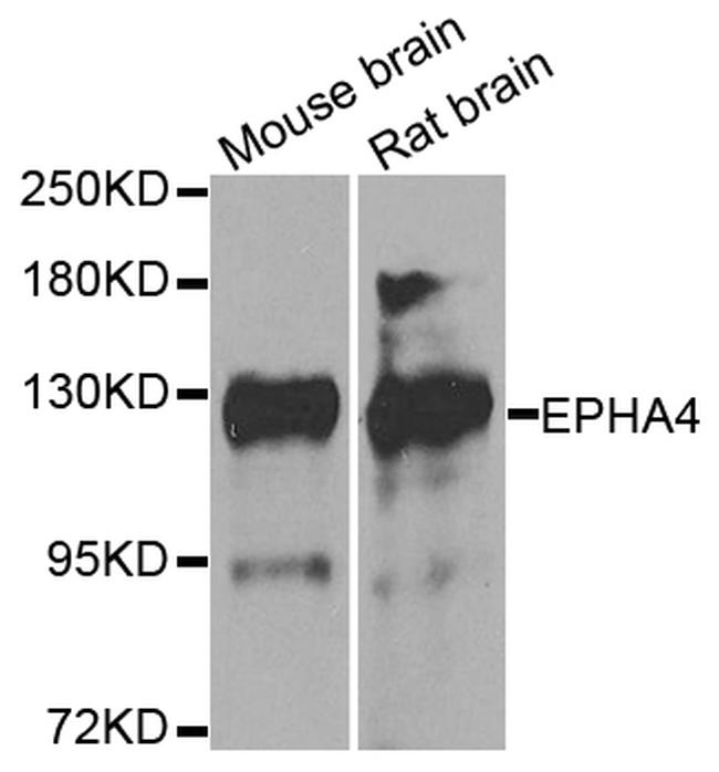 EphA4 Antibody in Western Blot (WB)