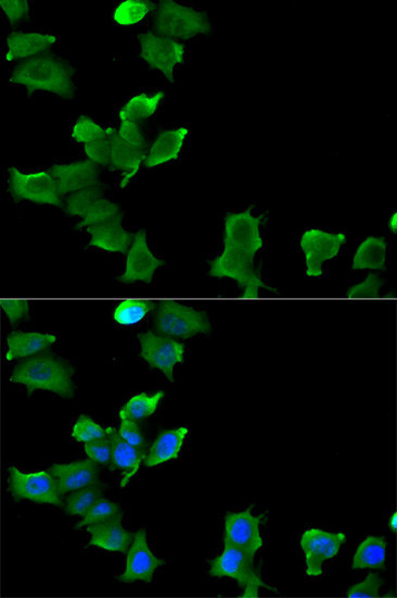 Glutamine Synthetase Antibody in Immunocytochemistry (ICC/IF)