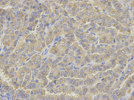 Glutamine Synthetase Antibody in Immunohistochemistry (Paraffin) (IHC (P))