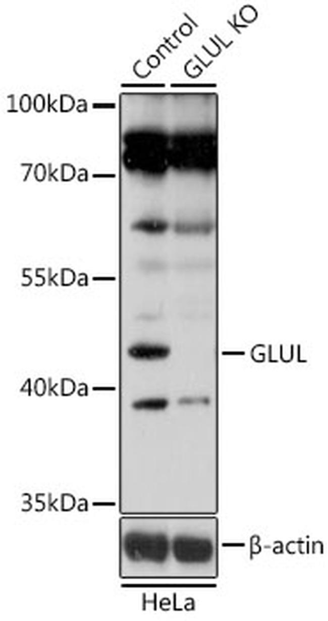 Glutamine Synthetase Antibody in Western Blot (WB)