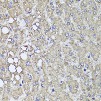 PIK3C2A Antibody in Immunohistochemistry (Paraffin) (IHC (P))