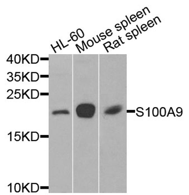 S100A9 Antibody in Western Blot (WB)