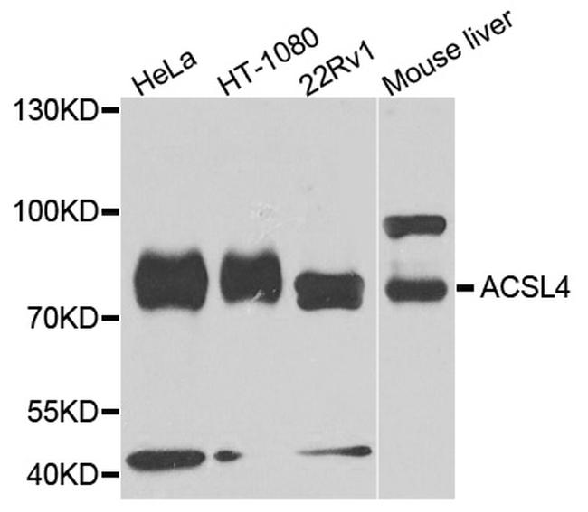 ACSL4 Antibody in Western Blot (WB)